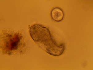 Strongyle (below) and coccidia (above) egg found on fecal flotation