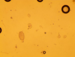 Strongyle and coccidia eggs found during a fecal egg count
